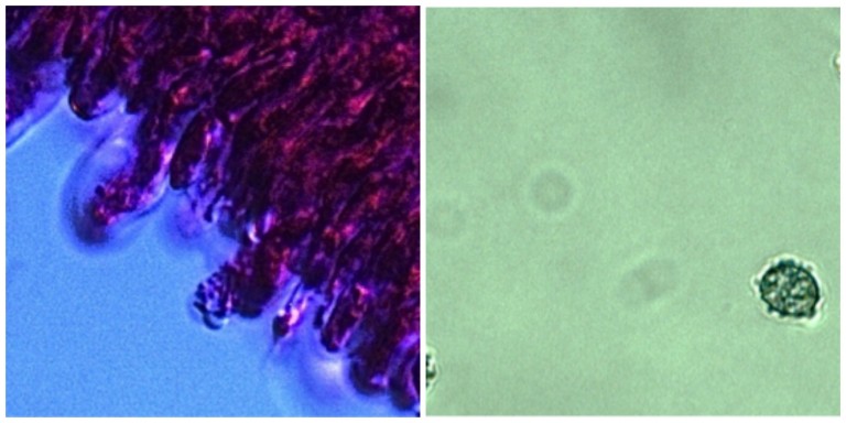: Important morphological characteristics include basidia (left), the spore-bearing structures in Basidiomycetes, as seen here in a slide from Amanita muscaria stained pink with Phloxine, and spores (right) from Lactarius glyciosmus, with warts and ornamentation reacting blue in Melzer’s reagent. Photos by Catriona Leven.